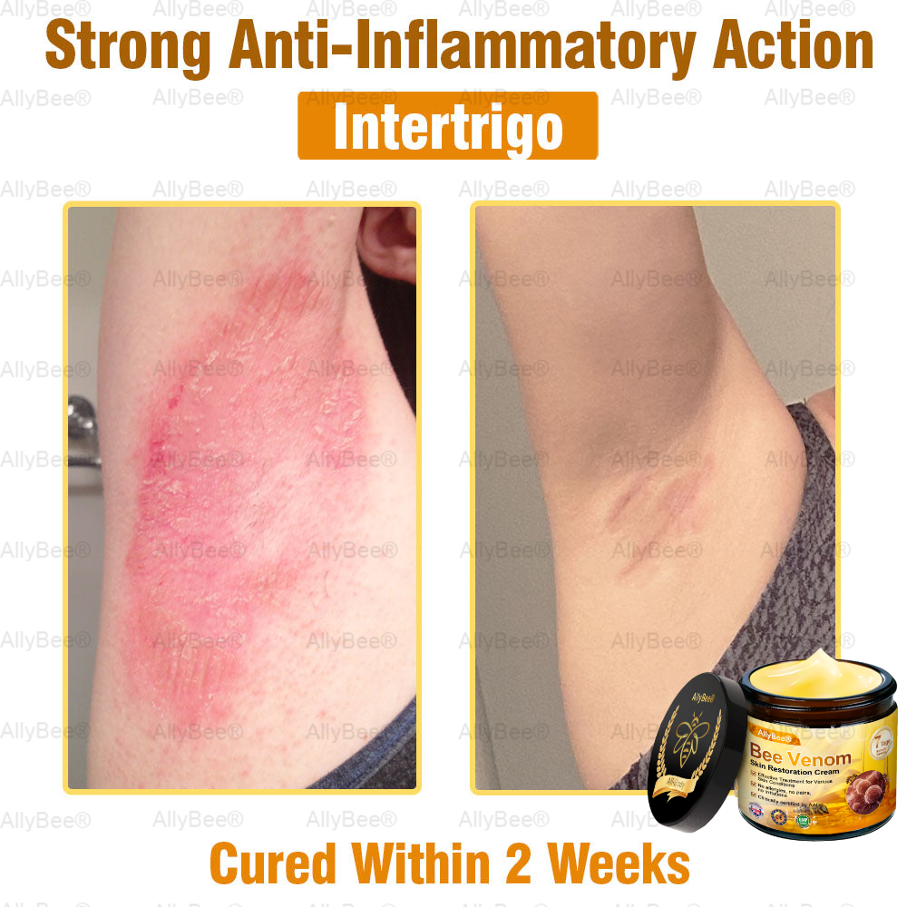 AllyBee® Only 10 jars!!! Get an exclusive 30% OFF now. ✨ See visible firming in just 7 days! ✔️ Backed by our 180-day money-back guarantee.