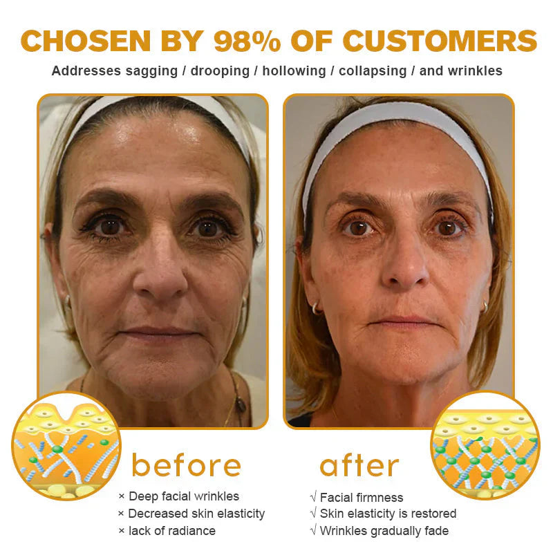 AllyBee® Only 10 jars!!! Get an exclusive 30% OFF now. ✨ See visible firming in just 7 days! ✔️ Backed by our 180-day money-back guarantee.