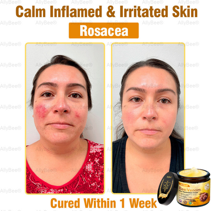 💐🌟💐 AllyBee® Last Chance! 70% OFF Skin Repair Cream,Fade scars, smooth skin, and glow naturally. Free air shipping & risk-free for 180 days.