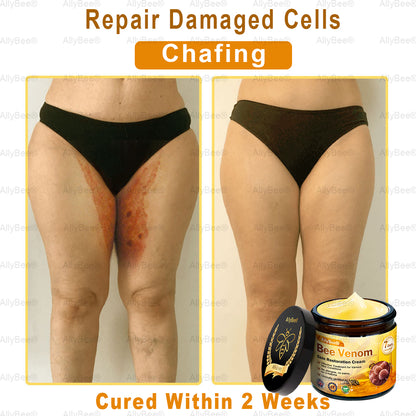 💐🌟💐 AllyBee® Last Chance! 70% OFF Skin Repair Cream,Fade scars, smooth skin, and glow naturally. Free air shipping & risk-free for 180 days.