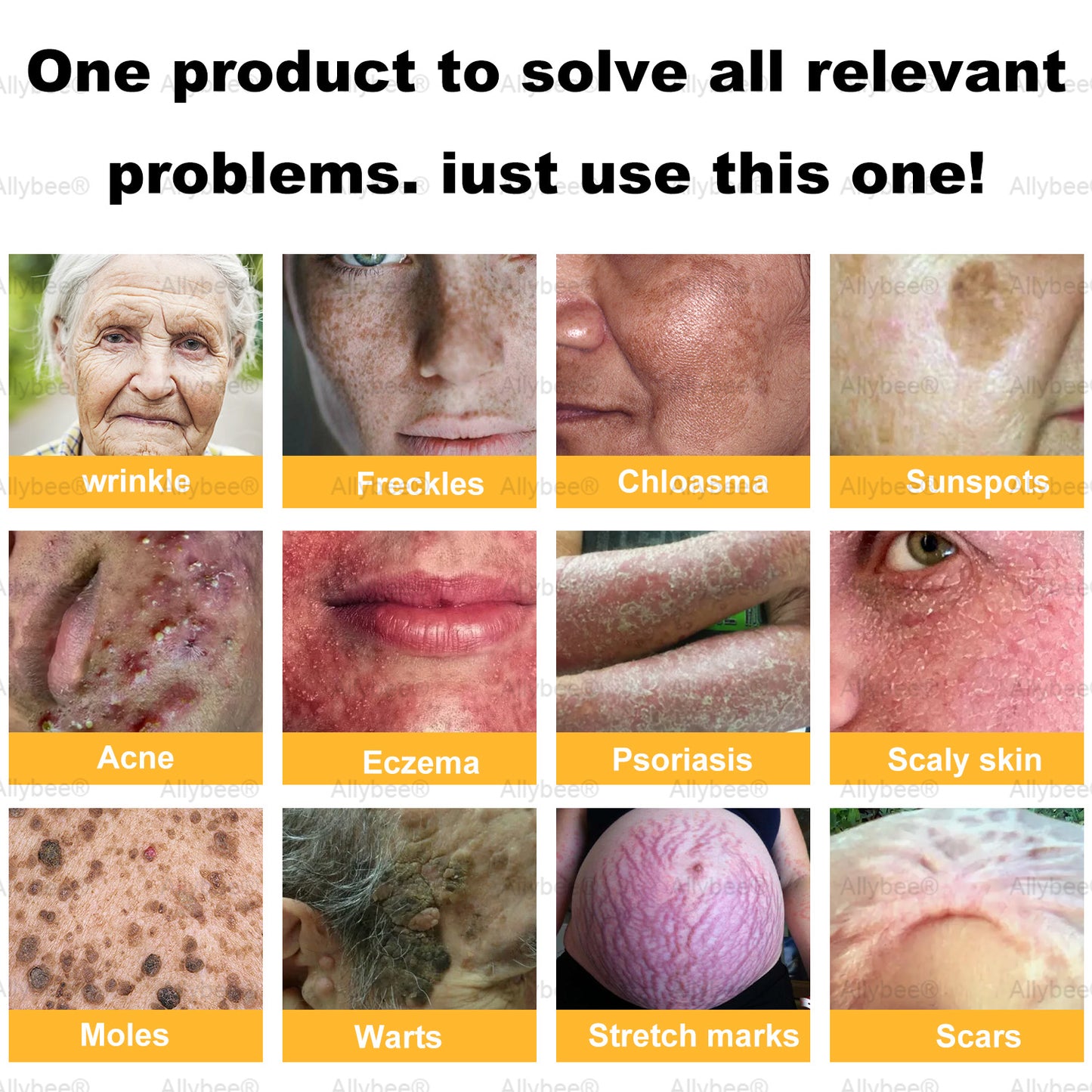 💐🌟💐 AllyBee® Last Chance! 70% OFF Skin Repair Cream,Fade scars, smooth skin, and glow naturally. Free air shipping & risk-free for 180 days.