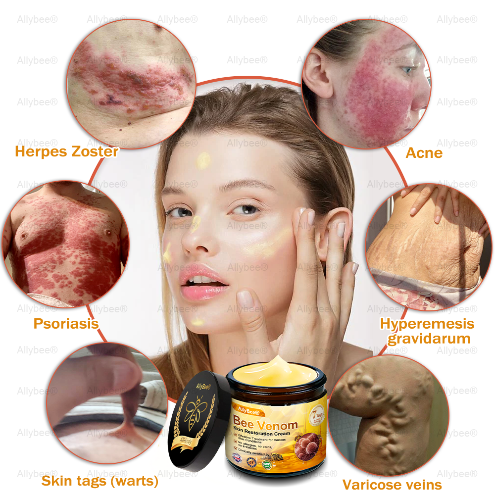 💐🌟💐 AllyBee® Last Chance! 70% OFF Skin Repair Cream,Fade scars, smooth skin, and glow naturally. Free air shipping & risk-free for 180 days.