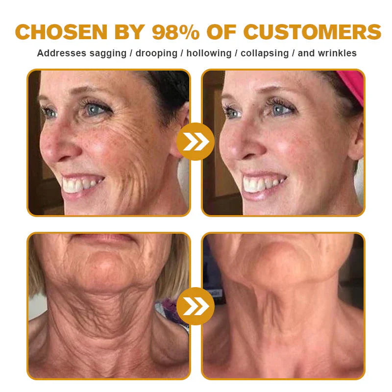 💐🌟💐 AllyBee® Last Chance! 70% OFF Skin Repair Cream,Fade scars, smooth skin, and glow naturally. Free air shipping & risk-free for 180 days.
