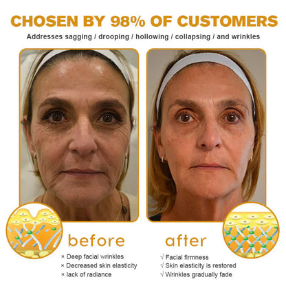 💐🌟💐 AllyBee® Last Chance! 70% OFF Skin Repair Cream,Fade scars, smooth skin, and glow naturally. Free air shipping & risk-free for 180 days.